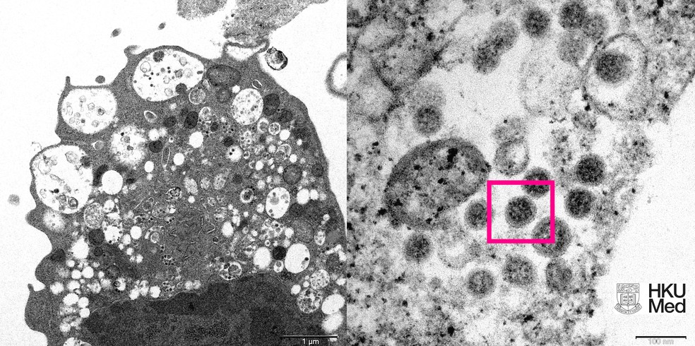 Mutação: Subvariante é mais infecciosa do que a ômicron, diz estudo