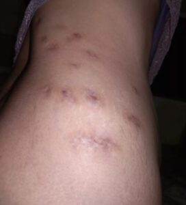 Dona de clínica de estética é investigada pelo CRF no Pará