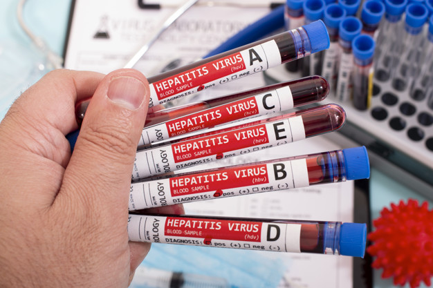 Primeiro caso provável de hepatite desconhecida e registra no Brasil