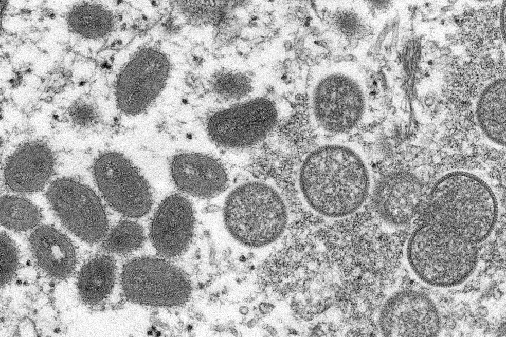 Brasil registra 1 caso de varíola do macaco em São Paulo