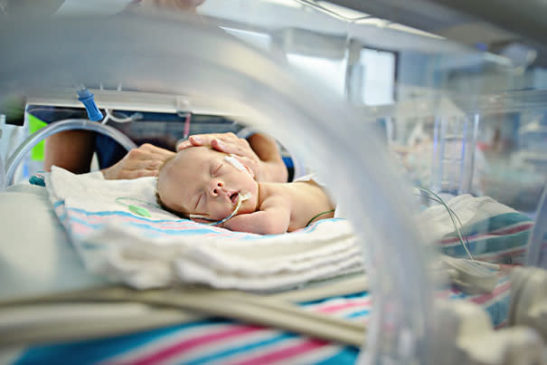 Recém-nascido precisou passar por um procedimento sanguíneo raro em hospital no Pará. O recém-nascido Henrique Pagei Kester