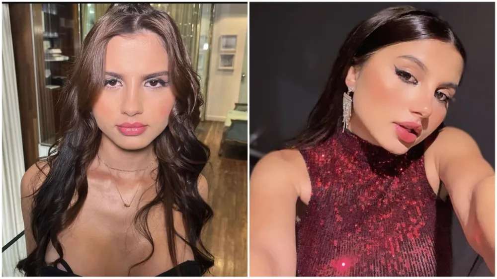 Gêmeas trans fizeram juntas cirurgias de redesignação de sexo.; As gêmeas transgênero Mayla Phoebe e Sofia Albuquerck, de 21 anos, estão