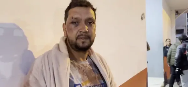 Idosa foi agredida por PM com soco em SP responderá por lesão corporal e desacato / A idosa agredida com um soco no rosto