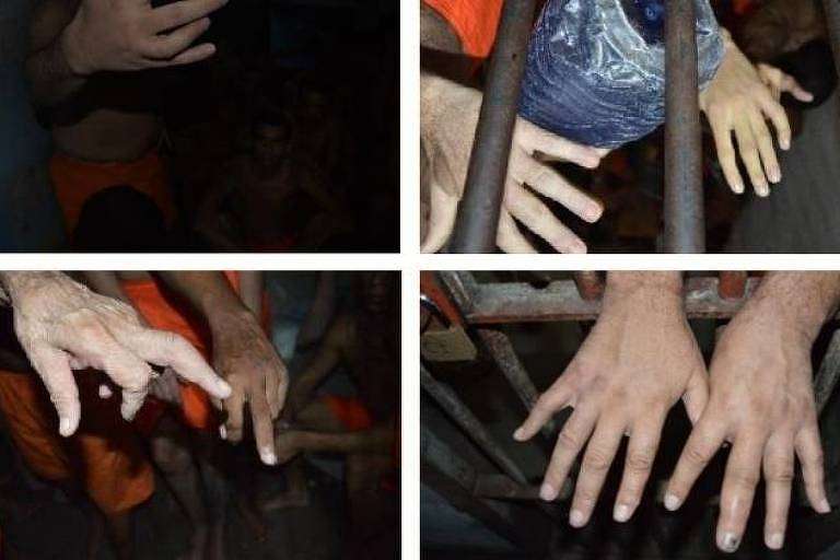 Presídio: Técnica de tortura de fraturar dedos de presos é usada em cinco estados do Brasil Uma técnica de tortura em que os dedos das mãos