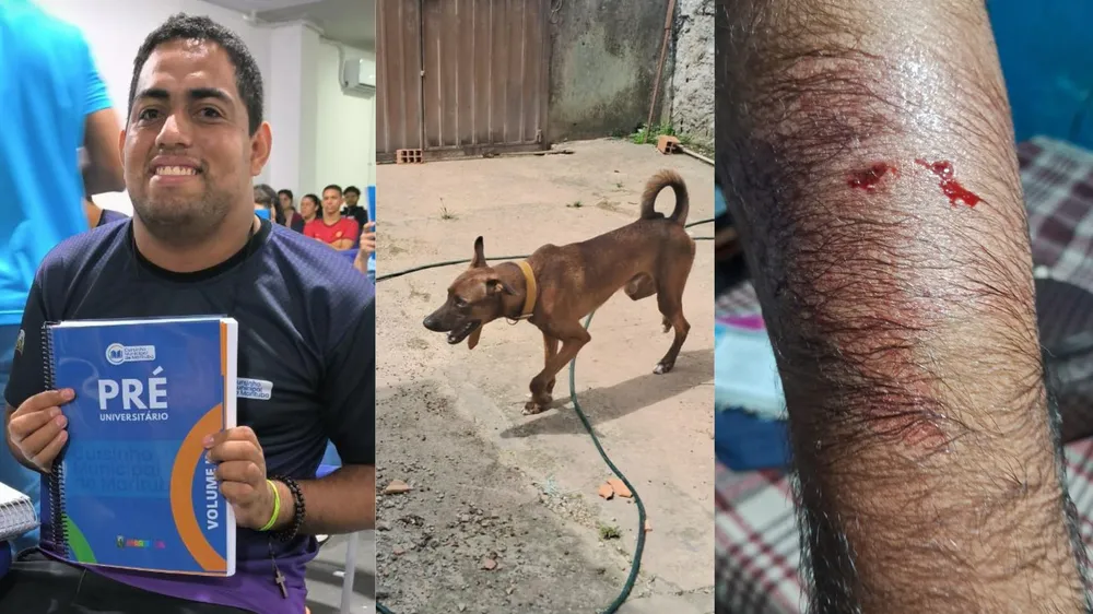 Estudante autista é atacado por cachorro a caminho da prova do EnemApesar do incidente, Igor Nascimento foi realizar a prova. Com o braço...