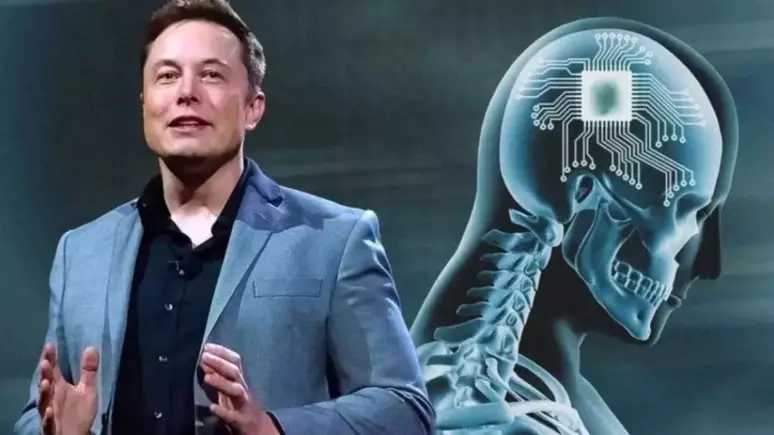 'Neuralink', do Bilionário Elon Musk, faz 1º implante de chip cerebral em humano Um paciente humano recebeu o primeiro implante de chip