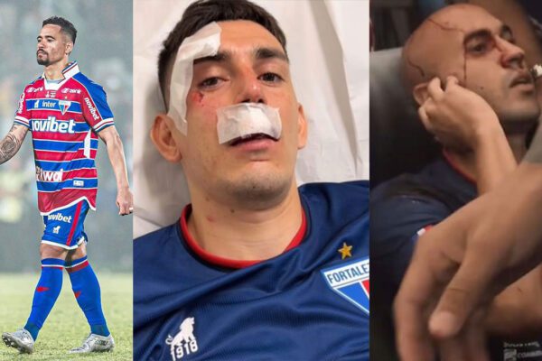 Ônibus do Fortaleza é apedrejado após jogo com Sport; jogadores ficam feridos Após o empate contra o Sport, o ônibus do Fortaleza foi
