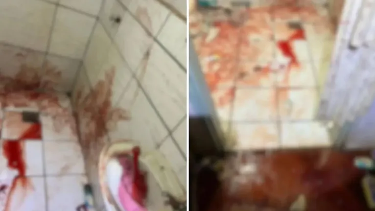 Tragédia: Vaso sanitário quebra durante uso e mulher vai parar na UTI Uma mulher de 46 anos ficou gravemente ferida após