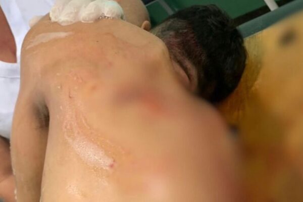 🚨Imagens Fortes: Discursão entre amigos durante jogo de futebol termina em morte após facada no coração Uma discussão entre amigos durante