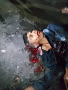 🚨Imagens Forte: Casal é executado por oito pistoleiros