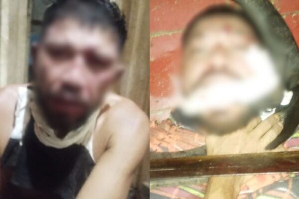 🚨VÍDEO: criminosos prometem matar suposto ladrão que teve mãos baleadas Novas imagens de um homem que foi baleado nas mãos por criminosos