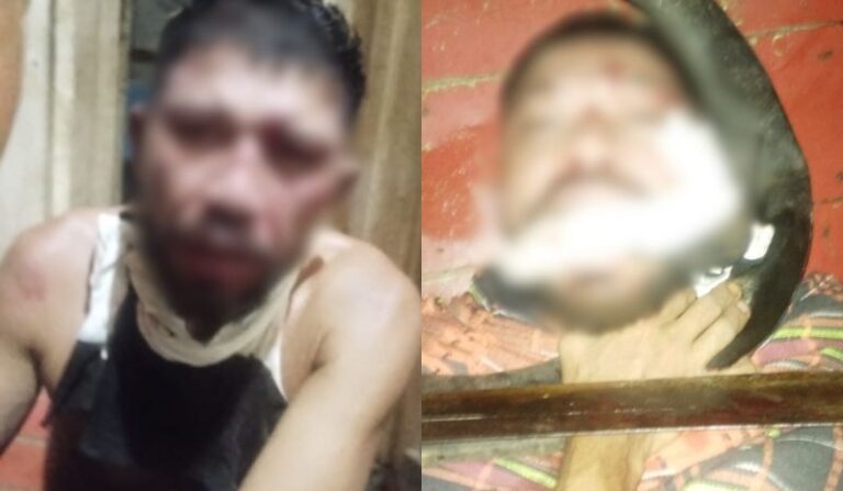 🚨VÍDEO: criminosos prometem matar suposto ladrão que teve mãos baleadas Novas imagens de um homem que foi baleado nas mãos por criminosos