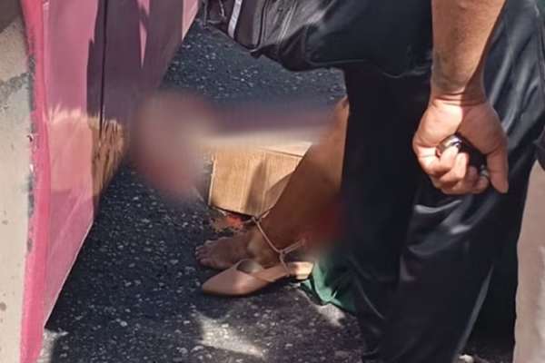 🚨Em Belém: Passageira de moto tem perna esmagada por ônibus durante corrida de aplicativo🏍 Um ônibus da linha "Canudos Praça Amazonas"