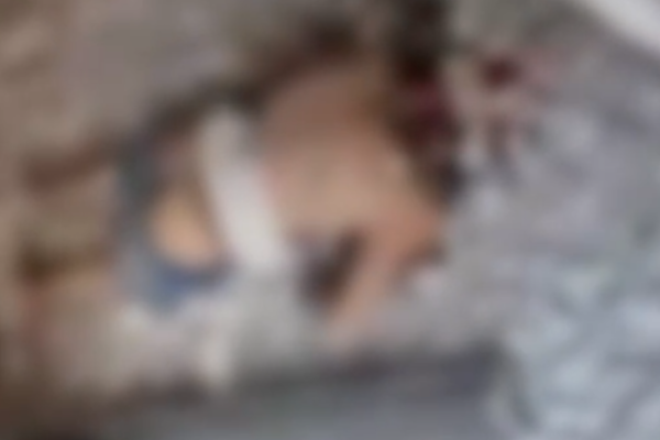 Explosão dentro de apartamento arranca cabeça e braços de homem; Veja o Vídeo Um jovem de 23 anos, não identificado, morreu pós uma