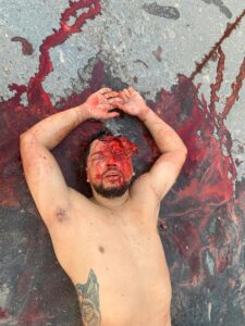 MANAUS: Motorista fica em estado grave após colisão de carreta com barranco