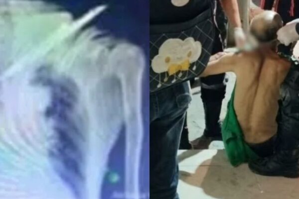 Idoso fica com faca cravada no pescoço após sofrer tentativa de homicídio.