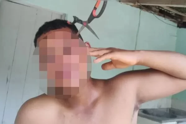 O homem tentou separar uma briga entre a namorada e a irmã dela, mas foi golpeado com uma tesoura pela cunhada...