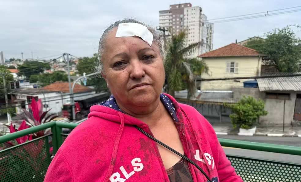 Idosa agredida por PM diz que foi algemada e levada em camburão