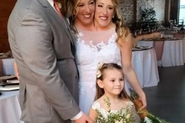 Gêmeas siamesas Abby e Brittany Hensel geraram especulações sobre gravidez