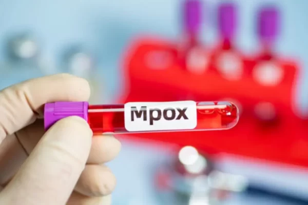 ​Belém é a cidade do PARÁ com maior número de casos de Mpox