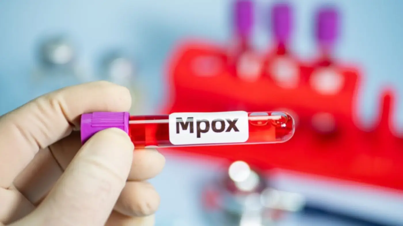 ​Belém é a cidade do PARÁ com maior número de casos de Mpox