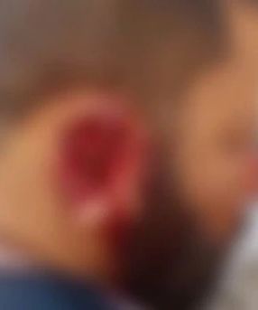 Um homem ficou gravemente ferido na tarde desta quinta-feira (26), após ser atacado por um cachorro da raça pitbull, em Itaituba...