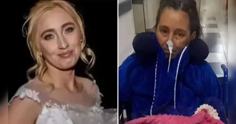 Mulher vai ao hospital para fazer laqueadura e acorda com novo coração sem a perna