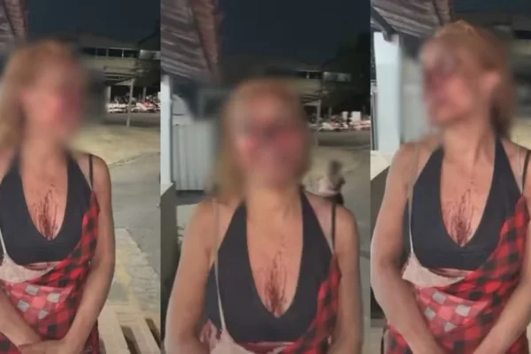 Advogada é espancada com pá de ferro e vassoura por vizinhas após discussão sobre lixo