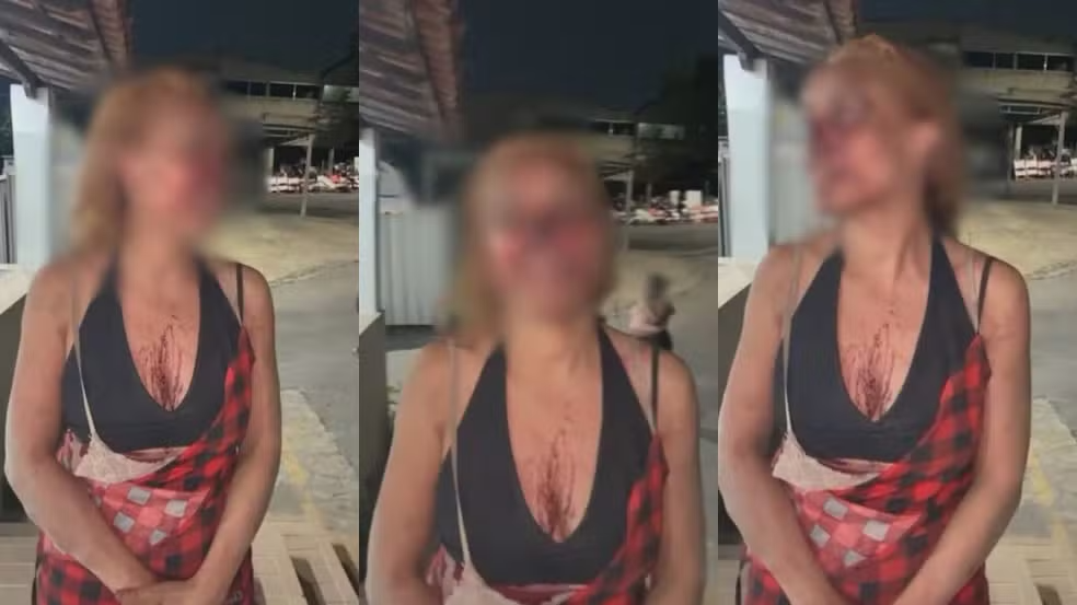 Advogada é espancada com pá de ferro e vassoura por vizinhas após discussão sobre lixo