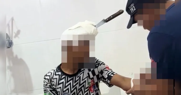 Vítima tem 14 anos e a facada na cabeça foi desferida pelo irmão mais novo. Um caso registrado na zona rural do município de...