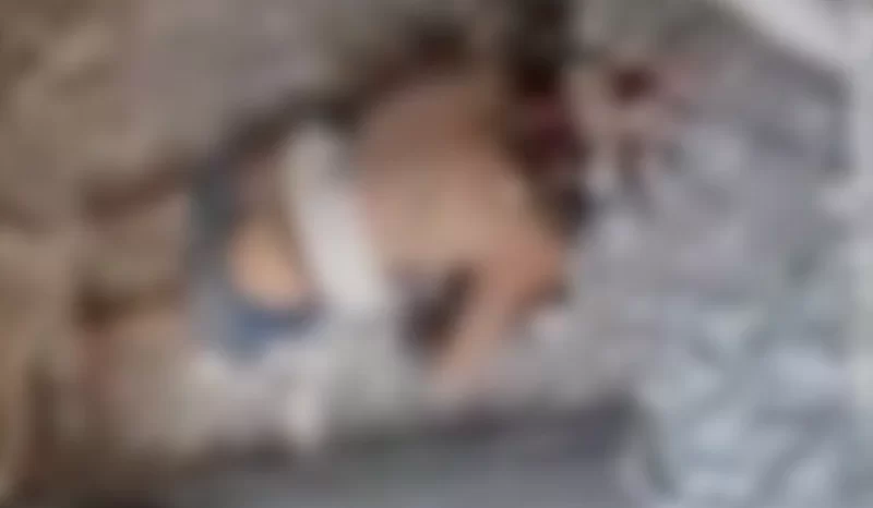 Explosão dentro de apartamento arranca cabeça e braços de homem; Veja o Vídeo Um jovem de 23 anos, não identificado, morreu pós uma